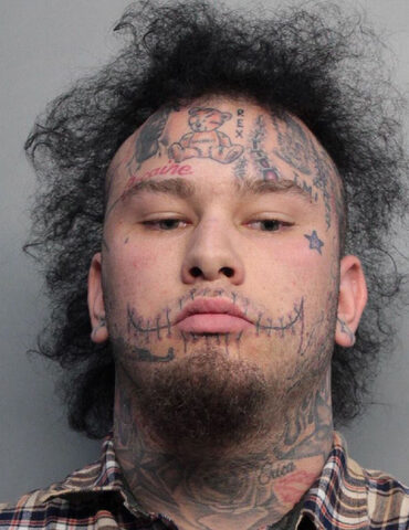 Are stitches in jail?