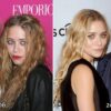 Did one of the Olsen twins have surgery?