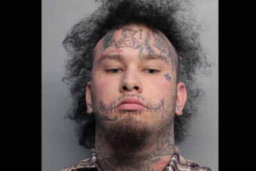 Are stitches in jail?