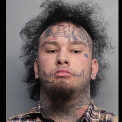 Are stitches in jail?