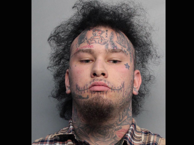 Are stitches in jail?