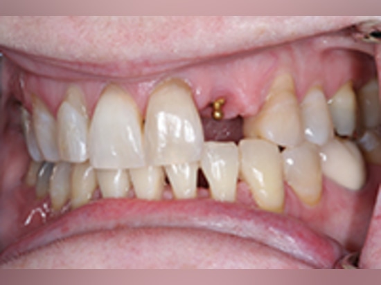 Comment savoir si mon dentiste prend le tiers payant ?