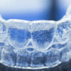 Comment savoir si notre mutuelle rembourse Invisalign ?