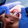 Comment savoir si le dentiste fait le tiers payant ?