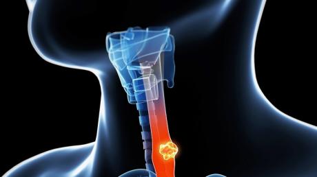 Qui pratique la circoncision adulte ?