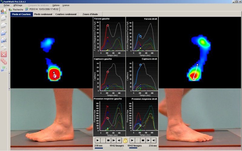 Qui peut faire des semelles orthopédiques ?