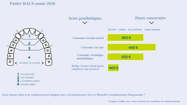 Quelles sont les prothèses dentaires remboursées par la Sécurité sociale ?